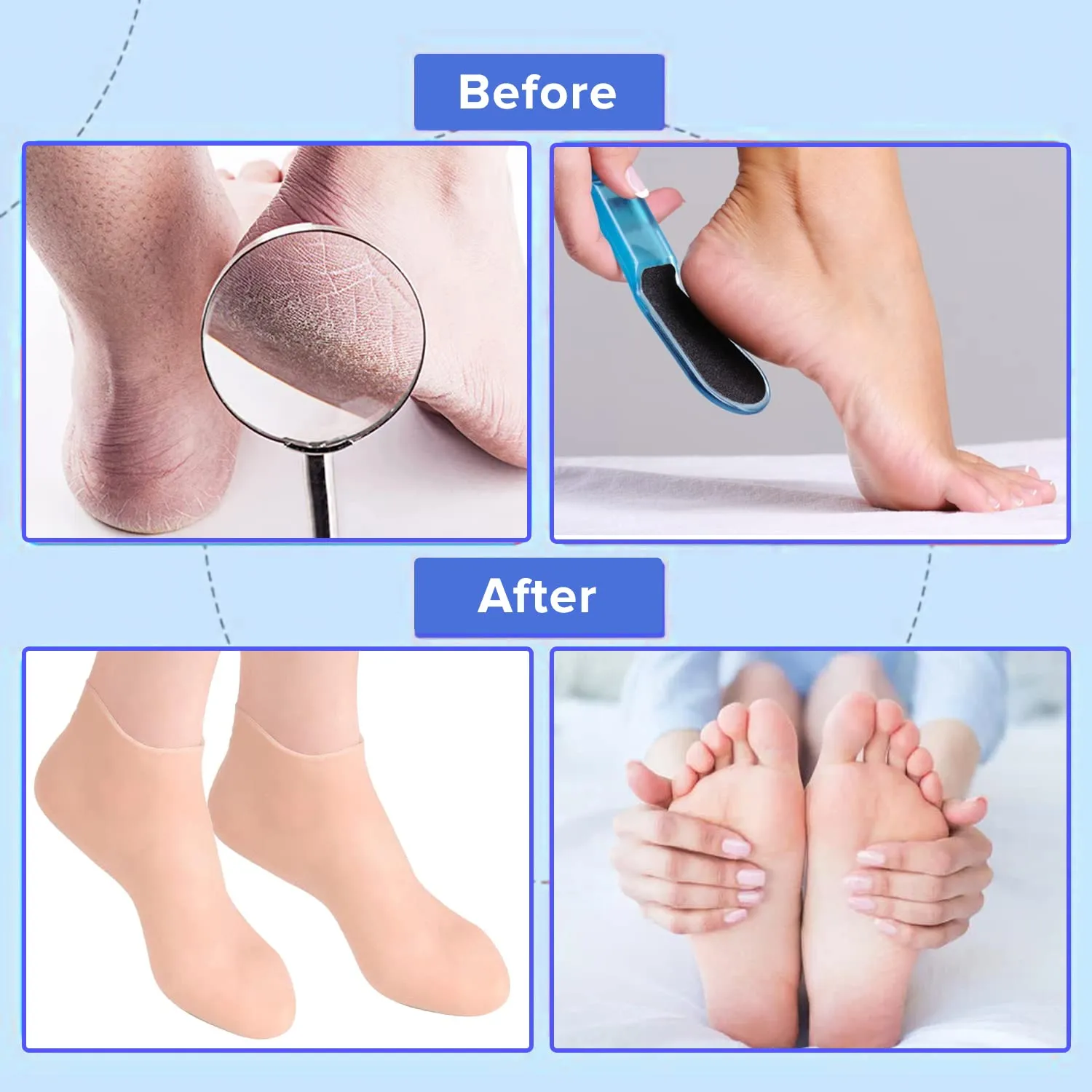 Dr Foot Silicone Socks | Anti Slip Silicone Moisturizing Socks | Dry Cracking Skin | For Both Men & Women | Full Length, Large Size – 1 Pair (Pack of 3)